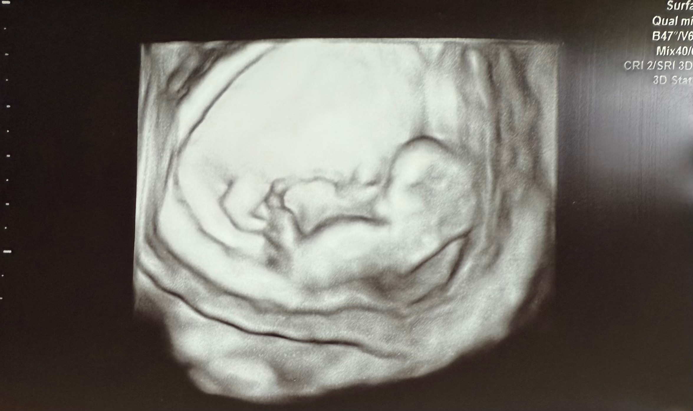 First Trimester To-Dos: My Unique Approach & Why